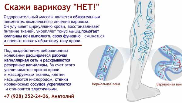 Что необходимо знать о варикозеВарикозное заболевание вен известно еще со времен Гиппократа, в то время целители уже начали лечить его, используя хирургические методы.